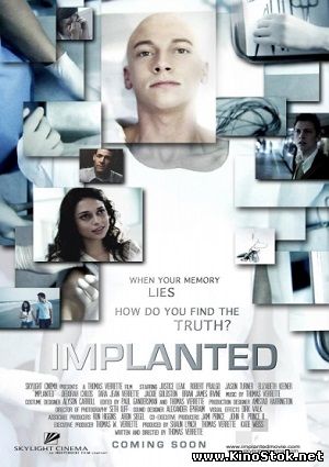 Имплант / Implanted